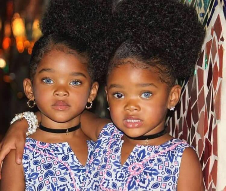 Bringing Special Daughters into The World